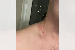 Gezocht: Mishandeling Bgm van Walsumweg Rotterdam-Centrum