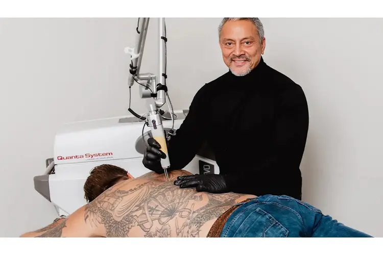 Tattoo laten verwijderen in Rotterdam:  Zorgvuldig kiezen voor het beste resultaat